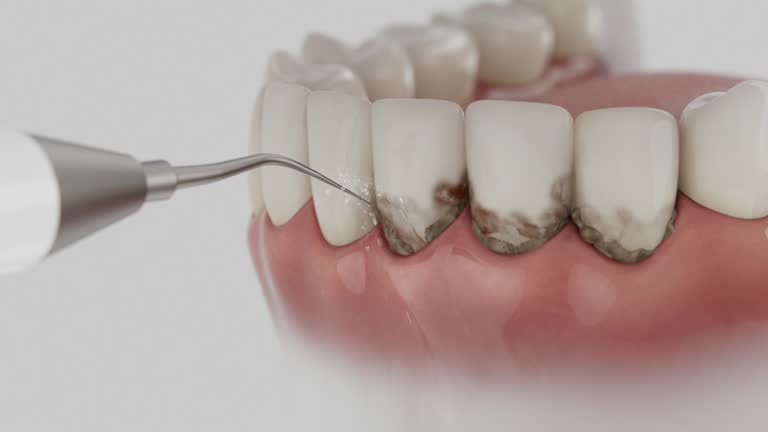 Reliable Dental Implants contractor in Duluth, WA by Smile Center Dentistry